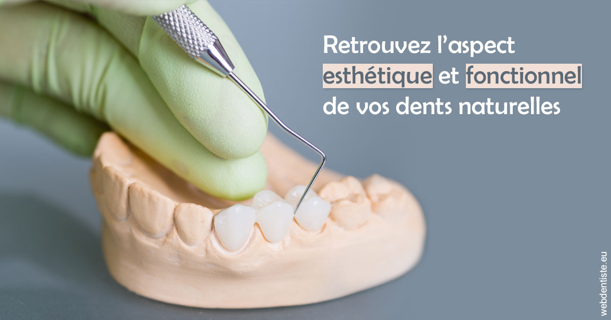 https://dr-aurelie-gonzalez.chirurgiens-dentistes.fr/Restaurations dentaires 1