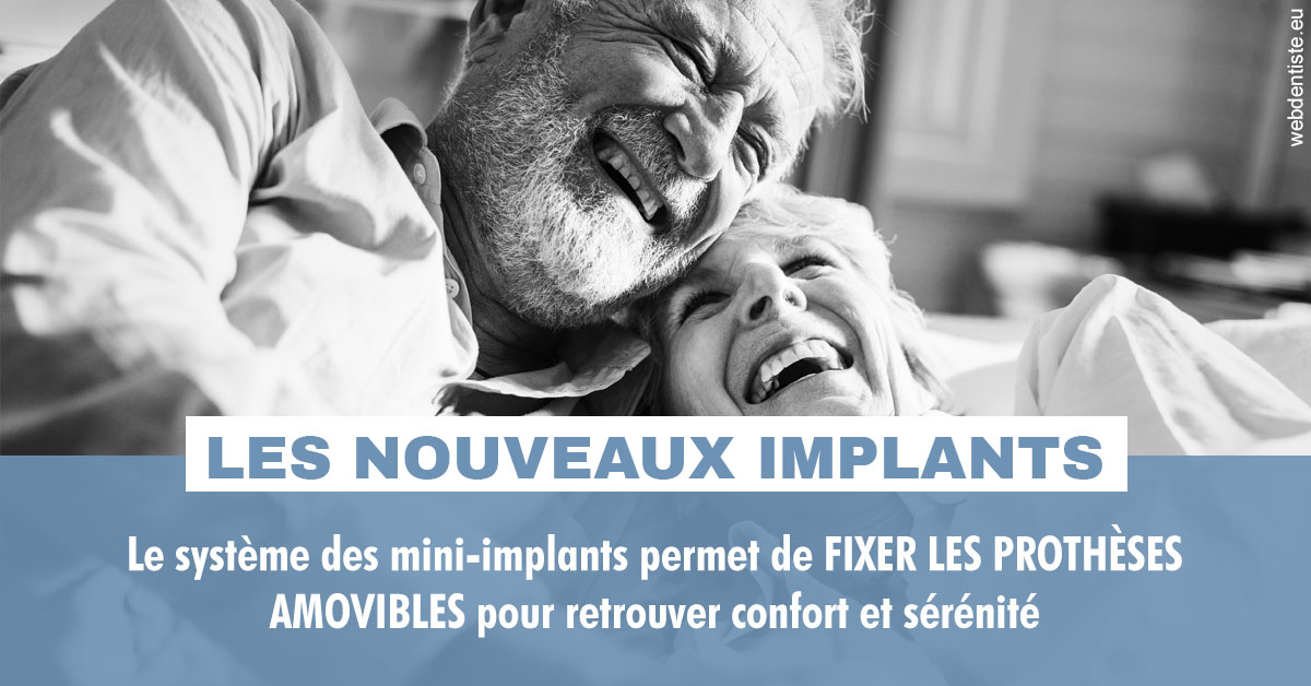 https://dr-aurelie-gonzalez.chirurgiens-dentistes.fr/Les nouveaux implants 2