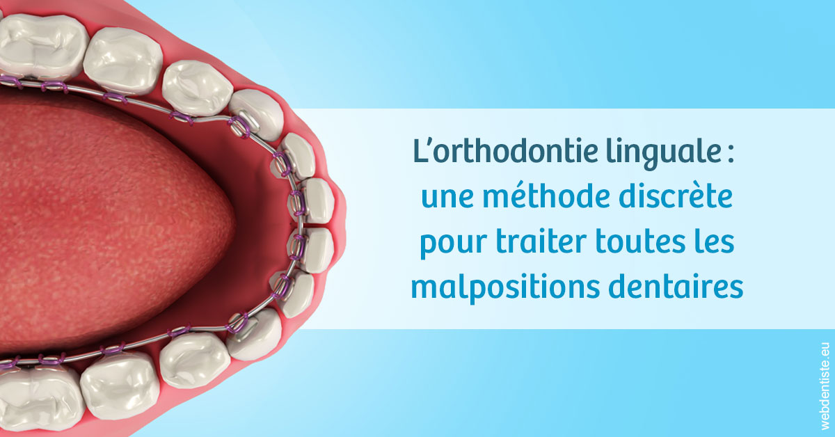 https://dr-aurelie-gonzalez.chirurgiens-dentistes.fr/L'orthodontie linguale 1