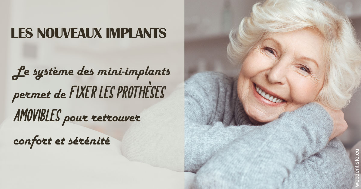 https://dr-aurelie-gonzalez.chirurgiens-dentistes.fr/Les nouveaux implants 1