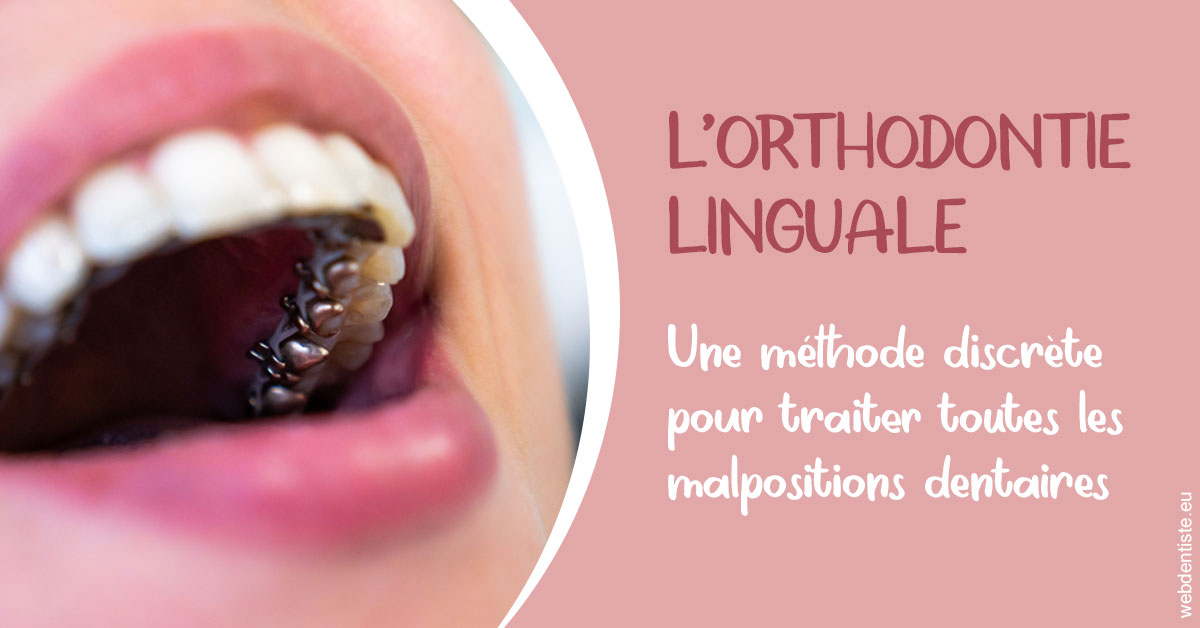 https://dr-aurelie-gonzalez.chirurgiens-dentistes.fr/L'orthodontie linguale 2