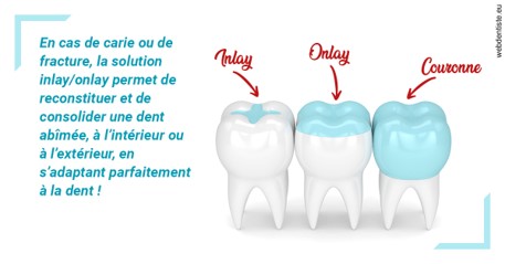 https://dr-aurelie-gonzalez.chirurgiens-dentistes.fr/L'INLAY ou l'ONLAY