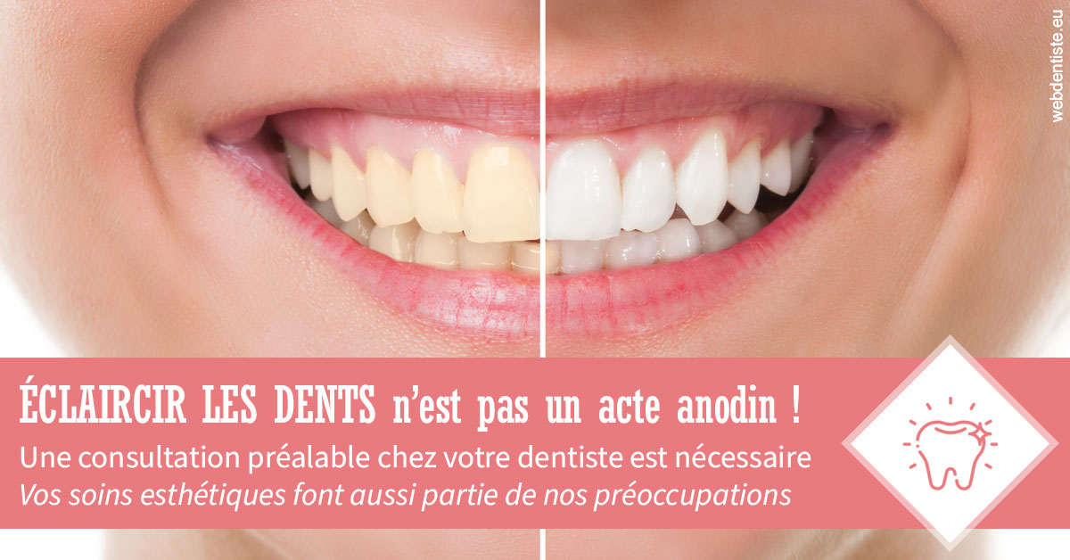 https://dr-aurelie-gonzalez.chirurgiens-dentistes.fr/Eclaircir les dents 1