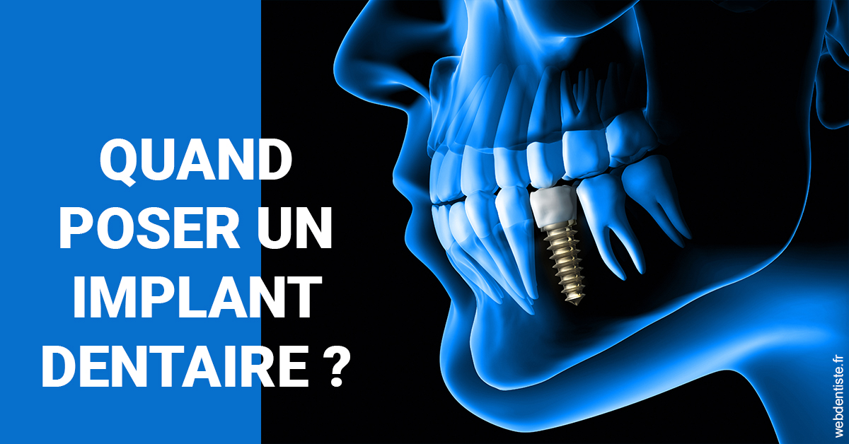 https://dr-aurelie-gonzalez.chirurgiens-dentistes.fr/Les implants 1