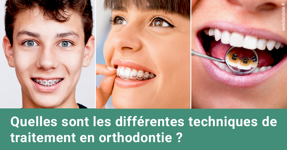 https://dr-aurelie-gonzalez.chirurgiens-dentistes.fr/Les différentes techniques de traitement 2