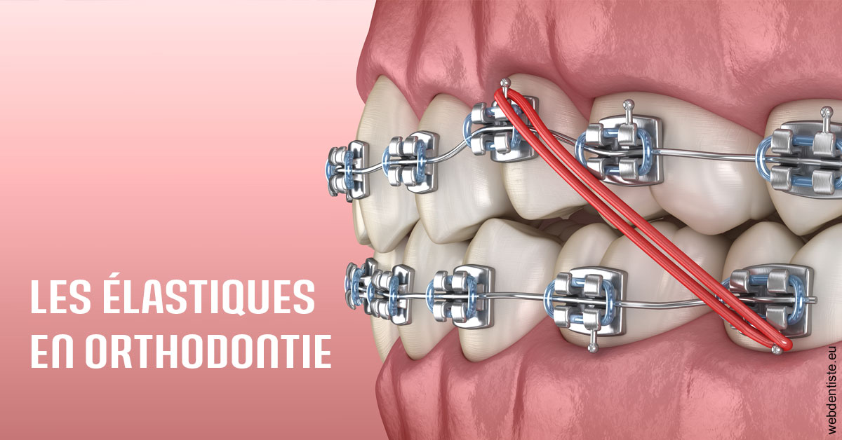 https://dr-aurelie-gonzalez.chirurgiens-dentistes.fr/Elastiques orthodontie 2