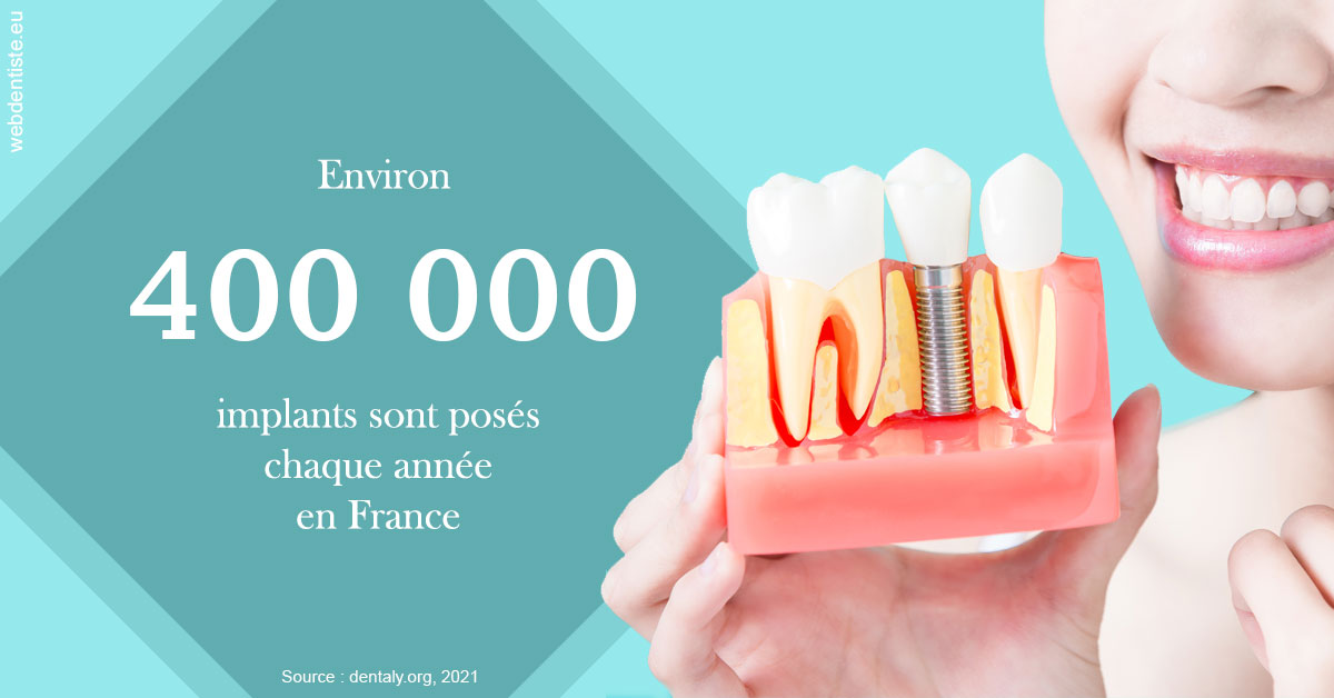 https://dr-aurelie-gonzalez.chirurgiens-dentistes.fr/Pose d'implants en France 2
